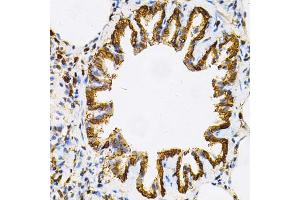 Immunohistochemistry of paraffin-embedded rat lung using HSP90AB1 Antibody (ABIN5970445) at dilution of 1/100 (40x lens). (HSP90AB1 anticorps)