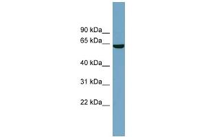 WB Suggested Anti-SLC5A8 Antibody Titration:  0. (SLC5A8 anticorps  (Middle Region))
