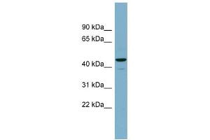 CANT1 antibody used at 1 ug/ml to detect target protein. (CANT1 anticorps  (Middle Region))