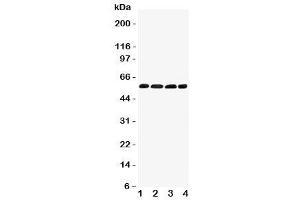 Western blot testing of IRF5 antibody and Lane 1:  human placenta (IRF5 anticorps  (C-Term))