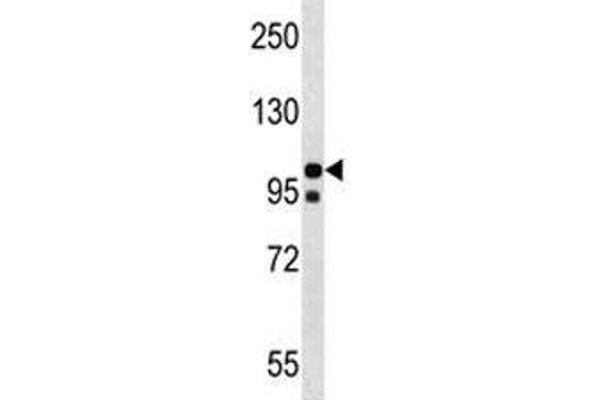 NLRP4 anticorps  (AA 121-149)