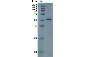 Human GFAP(68-377) Protein, His Tag on SDS-PAGE under reducing condition. (GFAP Protein (AA 68-377) (His tag))