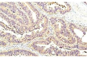 Immunohistochemistry of paraffin-embedded Human colon tissue using STAT1 Monoclonal Antibody at dilution of 1:200. (STAT1 anticorps)