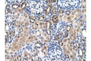 SLC46A3 antibody was used for immunohistochemistry at a concentration of 4-8 ug/ml to stain Epithelial cells of renal tubule (arrows) in Human Kidney. (SLC46A3 anticorps  (N-Term))