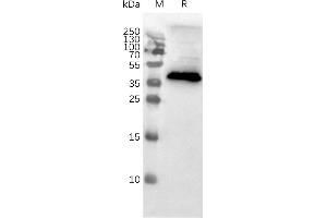 Western blot of MNPs (CCR8 Protéine)