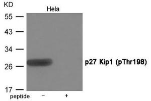 Western blot analysis of extracts from Hela cells using p27 Kip1 (Phospho-Thr198) Antibody. (CDKN1B anticorps  (pThr198))