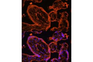 Immunofluorescence analysis of human placenta cells using LDB3 antibody (ABIN6128179, ABIN6143125, ABIN6143126 and ABIN6223347) at dilution of 1:100. (LIM Domain Binding 3 Protein anticorps  (AA 1-283))