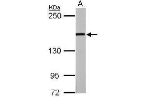 Western Blotting (WB) image for anti-GLI Family Zinc Finger 3 (GLI3) antibody (ABIN2855813)