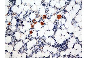 Immunohistochemistry (IHC) image for anti-Integrin Alpha2b (CD41) antibody (ABIN108423) (Integrin Alpha2b anticorps)