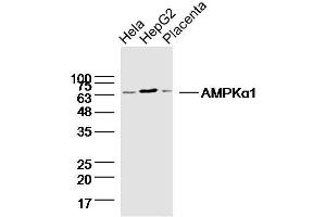 Lane1: HeLa lysates Lane 2: HepG2 lysates Lane 3: mouse placenta lysates probed with AMPK alpha-1 Polyclonal Antibody, Unconjugated  at 1:300 dilution and 4˚C overnight incubation. (PRKAA1 anticorps)