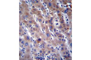 FADS2 Antibody immunohistochemistry analysis in formalin fixed and paraffin embedded human liver tissue followed by peroxidase conjugation of the secondary antibody and DAB staining. (FADS2 anticorps  (N-Term))