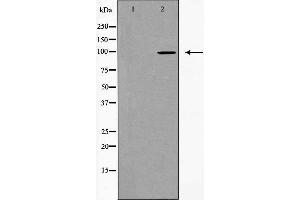 Western blot analysis of extracts from HeLa cells using PKP2 antibody. (Plakophilin 2 anticorps  (N-Term))