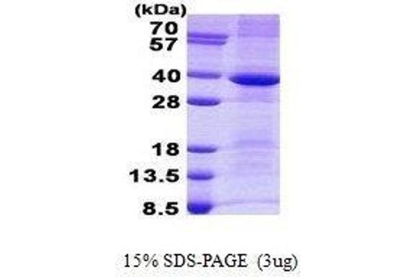 Cathepsin S Protein (CTSS)