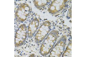 Immunohistochemistry of paraffin-embedded human colon using MYD88 Antibody. (MYD88 anticorps)