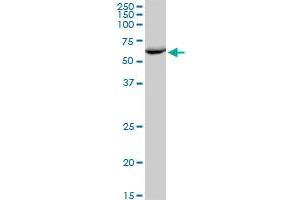 EPHX2 MaxPab polyclonal antibody. (EPHX2 anticorps  (AA 1-555))