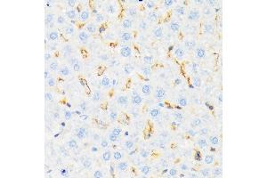 Immunohistochemistry of paraffin-embedded rat liver using CSK Rabbit mAb (ABIN1513217, ABIN3021034, ABIN3021035 and ABIN7101334) at dilution of 1:100 (40x lens). (CSK anticorps)