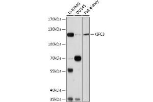 Western blot analysis of extracts of various cell lines, using KIFC3 antibody  at 1:1000 dilution. (KIFC3 anticorps  (AA 140-390))