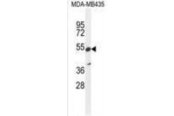 ZNF98 anticorps  (C-Term)