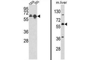 (LEFT) Western blot analysis of MCCC2 Antibody (Center) in CEM, 293 cell line lysates (35ug/lane). (MCCC2 anticorps  (Middle Region))