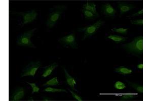 Immunofluorescence of purified MaxPab antibody to PSMB7 on HeLa cell. (PSMB7 anticorps  (AA 1-277))