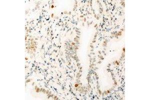 Immunohistochemical analysis of THOC1 staining in mouse kidney formalin fixed paraffin embedded tissue section. (THOC1 anticorps)