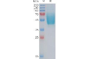 Human CGRPR Protein, mFc Tag on SDS-PAGE under reducing condition. (CALCRL Protein (AA 23-140) (mFc Tag))