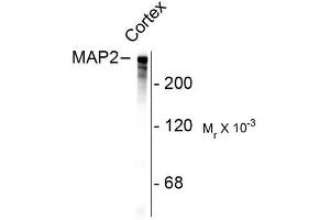 Image no. 1 for anti-Microtubule-Associated Protein 2 (MAP2) antibody (ABIN372661) (MAP2 anticorps)