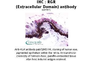 Image no. 1 for anti-Retinal G Protein Coupled Receptor (RGR) (2nd Extracellular Domain) antibody (ABIN1738847) (RGR anticorps  (2nd Extracellular Domain))