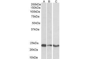 ABIN2560535 (0. (TREM2 anticorps  (C-Term))