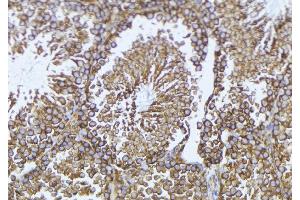 ABIN6269388 at 1/100 staining Mouse testis tissue by IHC-P. (CPI-17 anticorps  (Internal Region))