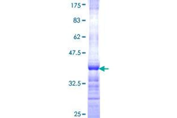 HFE2 Protein (AA 93-173) (GST tag)