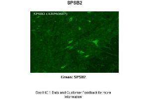 Sample Type : Rhesus macaque spinal cord Primary Antibody Dilution : 1:300 Secondary Antibody : Donkey anti Rabbit 488 Secondary Antibody Dilution : 1:500 Color/Signal Descriptions : Green: SPSB2 Gene Name : SPSB2 Submitted by : Timur Mavlyutov, Ph. (SPSB2 anticorps  (N-Term))