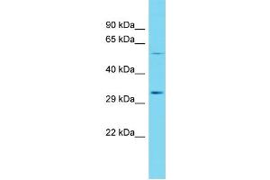 Host: Rabbit Target Name: CDKL4 Sample Type: Fetal Heart lysates Antibody Dilution: 1. (CDKL4 anticorps  (N-Term))