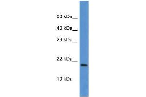 WB Suggested Anti-Fxn Antibody Titration: 1. (Frataxin anticorps  (C-Term))