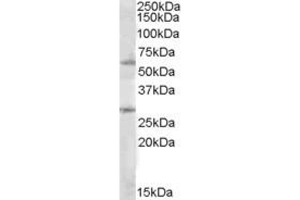 SOCS7 anticorps  (Internal Region)