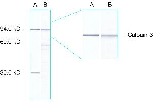 Western Blot: analysis of human skeletal muscle showing detection of calpain 3 proteins. (Calpain anticorps  (AA 1-19))