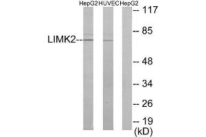 Western Blotting (WB) image for anti-LIM Domain Kinase 2 (LIMK2) (Internal Region) antibody (ABIN1849457) (LIMK2 anticorps  (Internal Region))