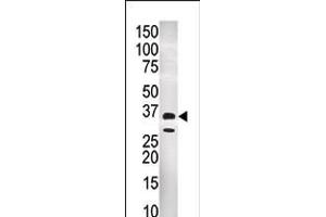 Western blot analysis of anti-GNMT Pab in CEM cell line tissue lysate (35ug/lane) (GNMT anticorps  (C-Term))