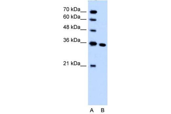 SLC25A29 anticorps  (C-Term)