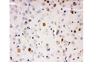 IHC-P: AHR antibody testing of mouse brain tissue (Aryl Hydrocarbon Receptor anticorps  (C-Term))