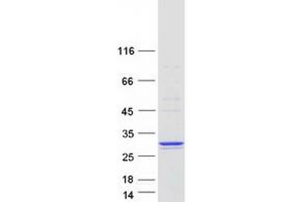 COMMD5 Protein (Transcript Variant 1) (Myc-DYKDDDDK Tag)