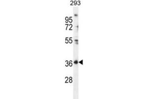 Western Blotting (WB) image for anti-Folate Receptor 4 (Delta) (FOLR4) antibody (ABIN2996480) (Folate Receptor 4 anticorps)