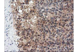 Immunohistochemical staining of paraffin-embedded Human breast tissue using anti-ADIPOQ mouse monoclonal antibody. (ADIPOQ anticorps  (AA 19-244))