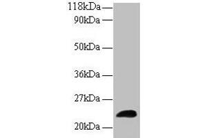 Western blot All lanes: LCN2 antibody at 2 μg/mL + Human positive serum Secondary Goat polyclonal to rabbit IgG at 1/15000 dilution Predicted band size: 23 kDa Observed band size: 23 kDa (Lipocalin 2 anticorps  (AA 1-198))