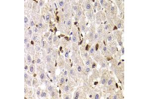 Immunohistochemistry of paraffin-embedded human liver injury using SPN antibody. (CD43 anticorps)