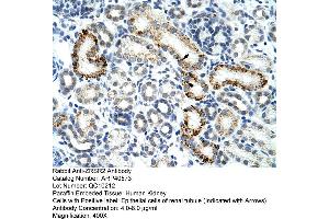 Rabbit Anti-ZESR2 Antibody  Paraffin Embedded Tissue: Human Kidney Cellular Data: Epithelial cells of renal tubule Antibody Concentration: 4. (ZRSR2 anticorps  (C-Term))