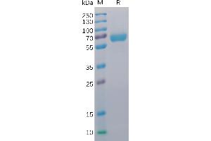 Human CD48 Protein, mFc-His Tag on SDS-PAGE under reducing condition. (CD48 Protein (CD48) (AA 27-220) (mFc-His Tag))