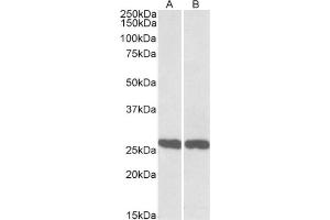 AP21292PU-N UCHL1 antibody staining of Mouse (A) and Rat (B) Brain lysate at 0. (UCHL1 anticorps  (C-Term))