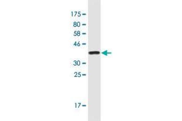 Surfactant Protein A1 anticorps  (AA 83-199)