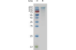 Mouse CEA Protein, His Tag on SDS-PAGE under reducing condition. (CEACAM5 Protein (AA 35-947) (His tag))